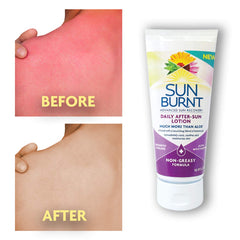 SunBurnt Lotion non-greasy texture closeup emphasizing instant cooling feel