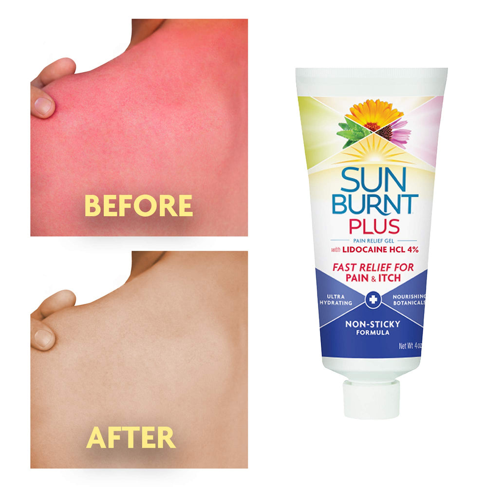 Sunburnt Plus After-Sun Gel cream texture spreads smoothly over skin.