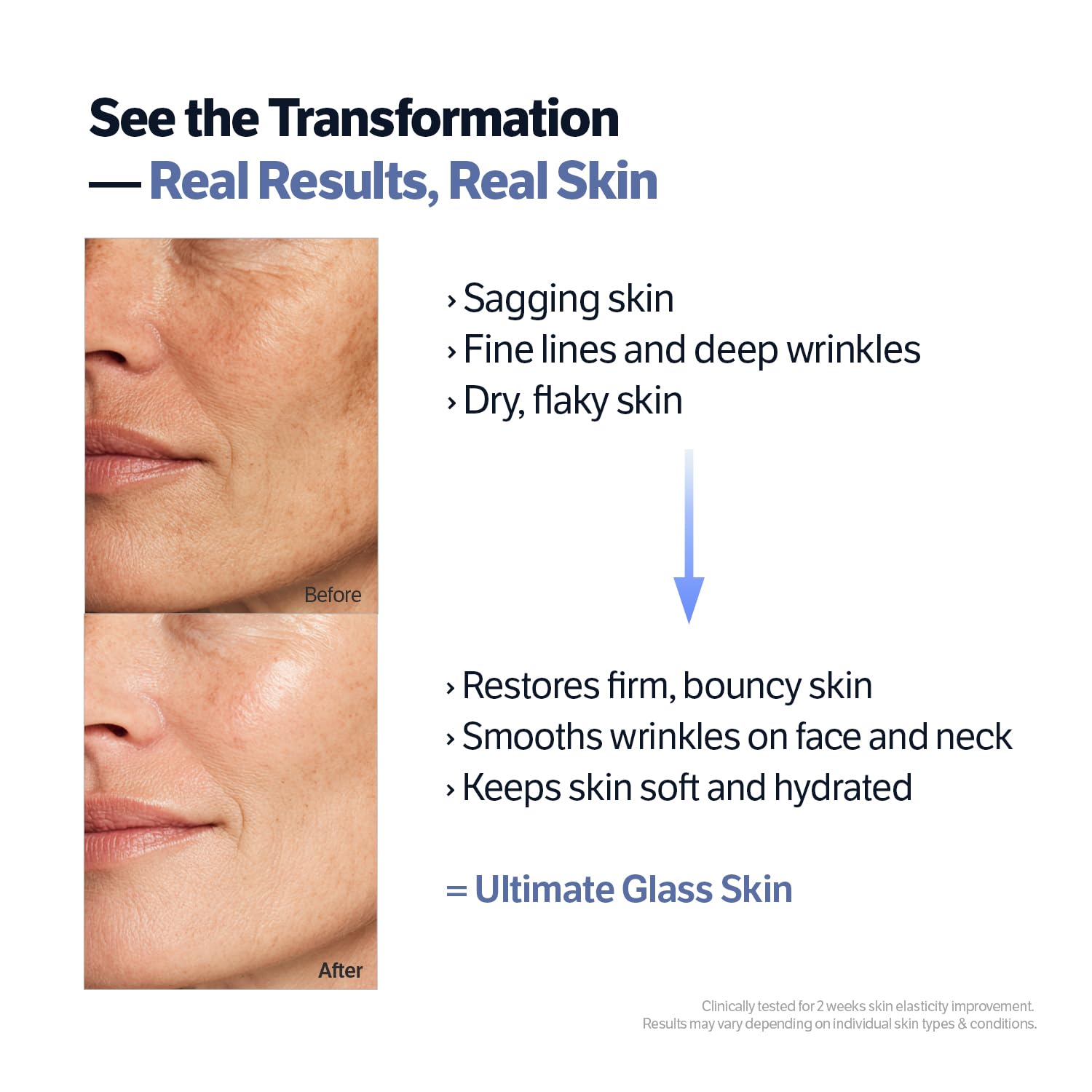 Sungboon Editor Deep Collagen Retinol Cream micro-spicule close-up indicating gentle stimulation