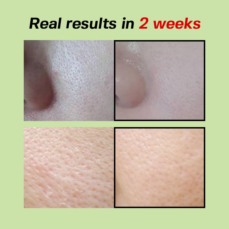 Sungboon Editor Green Tomato Pore Lifting Ampoule niacinamide illustration.