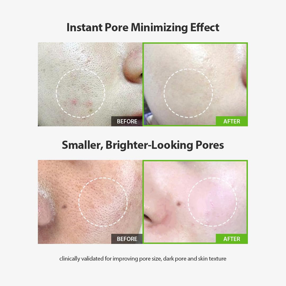 Sungboon Editor Green Tomato Pore Lifting Ampoule applied to the skin for a smoother look.
