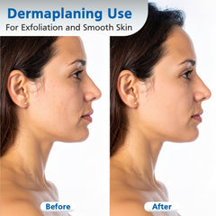 Swann Morton compact #10R blade designed for small contoured facial areas with control.