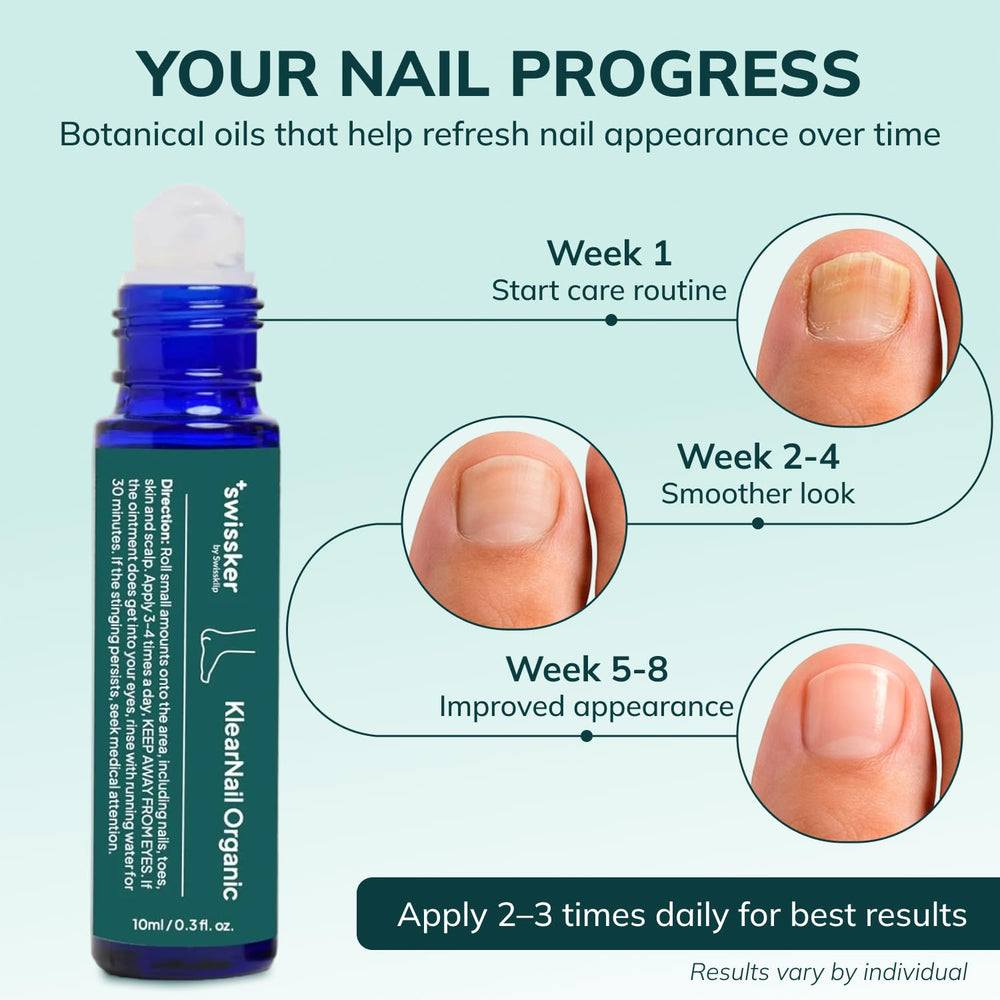 Swissklip KlearNail nail appearance after treatment shows brighter nails