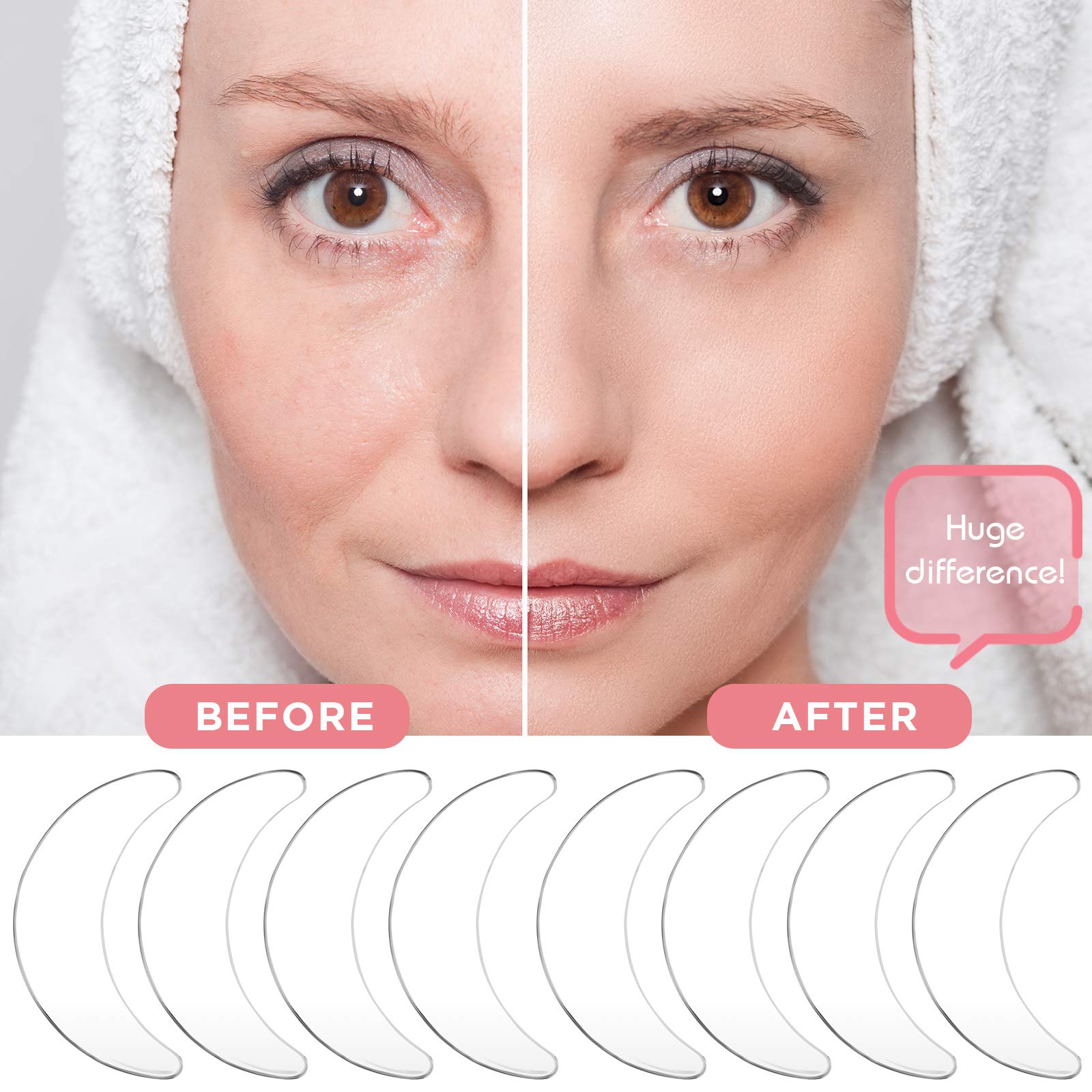 Syhood silicone eye wrinkle pads applied to eye area for smoothing and moisturizing potential.