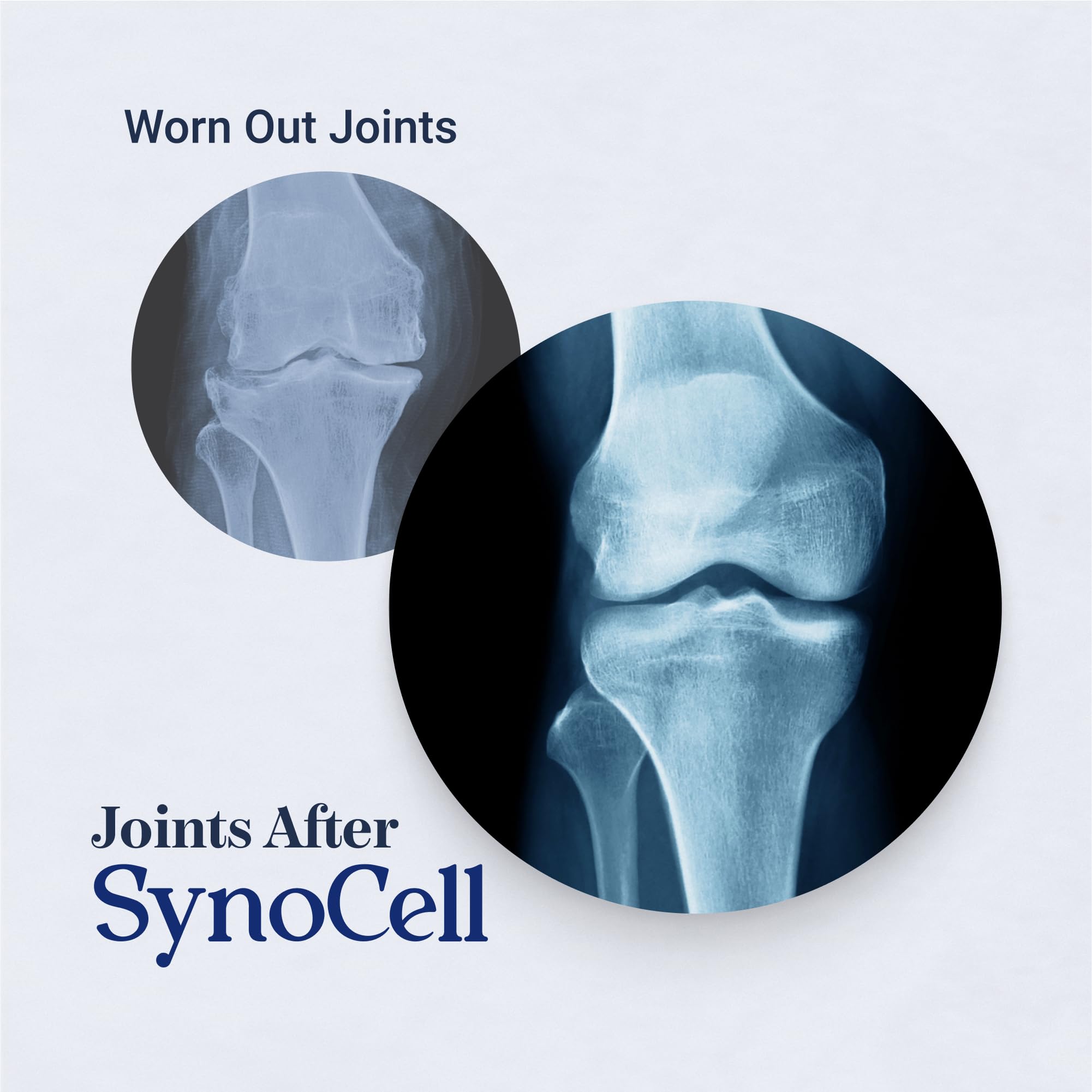 Synocell Boswellia Quercetin capsules closeup promoting flexible movement.