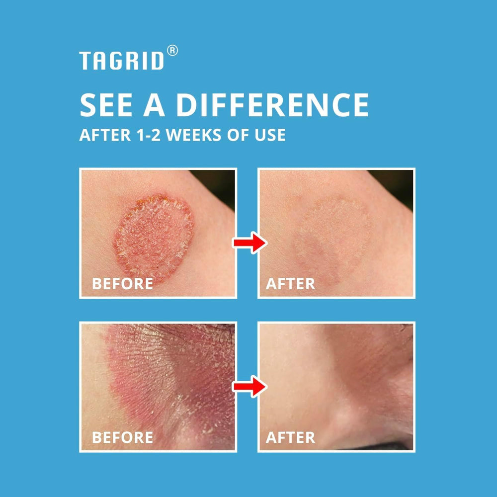 TAGRID Antifungal Cream label shows FDA-listed formula.