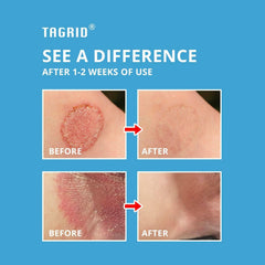 TAGRID Antifungal Cream label shows FDA-listed formula.