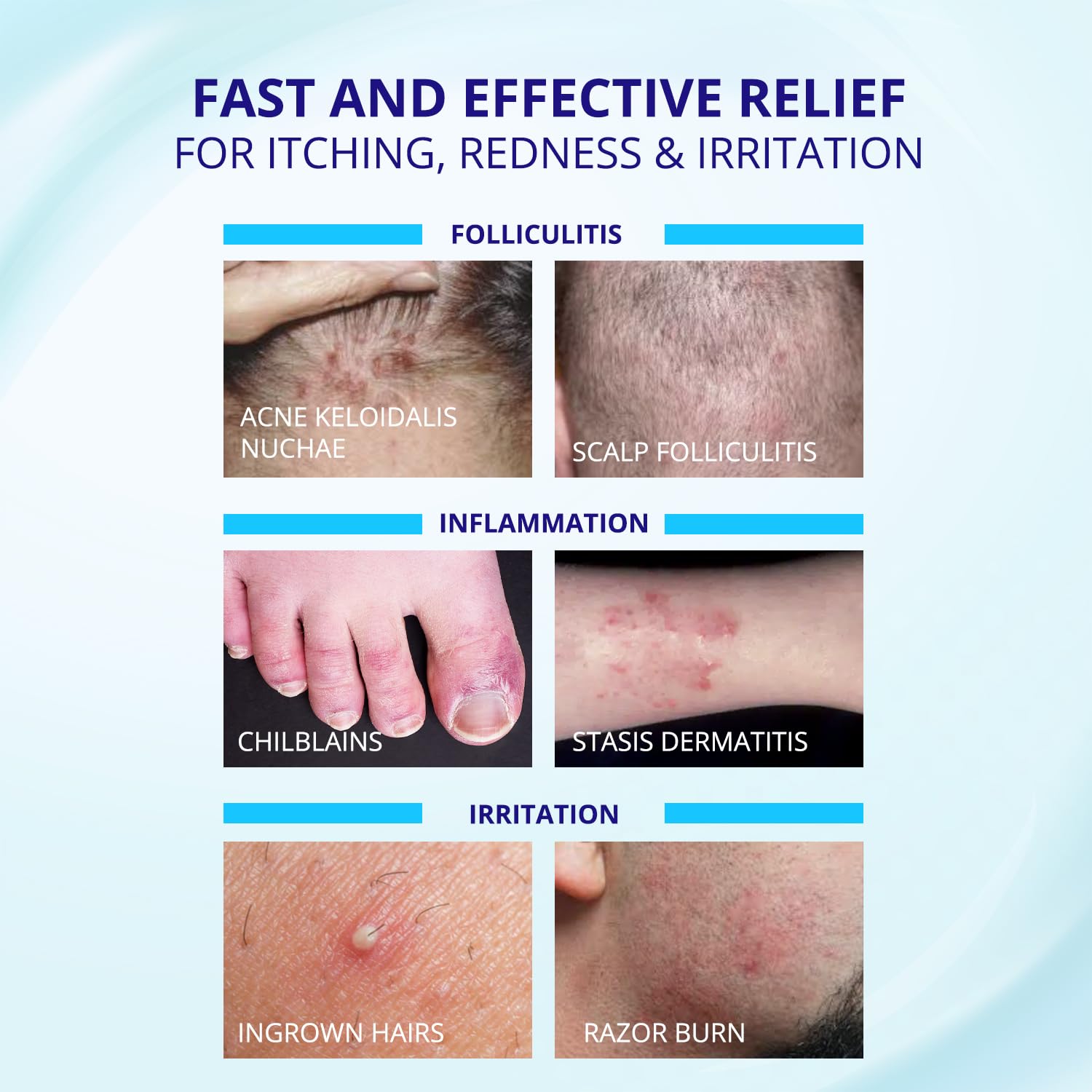 Application areas graphic highlights scalp and body use with gentle care.