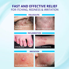 Application areas graphic highlights scalp and body use with gentle care.