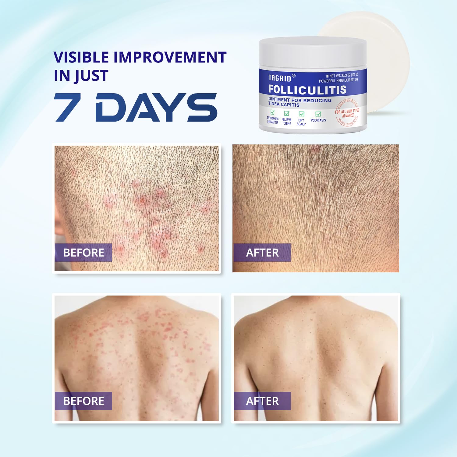 Skin surface after use looks calmer and less irritated.