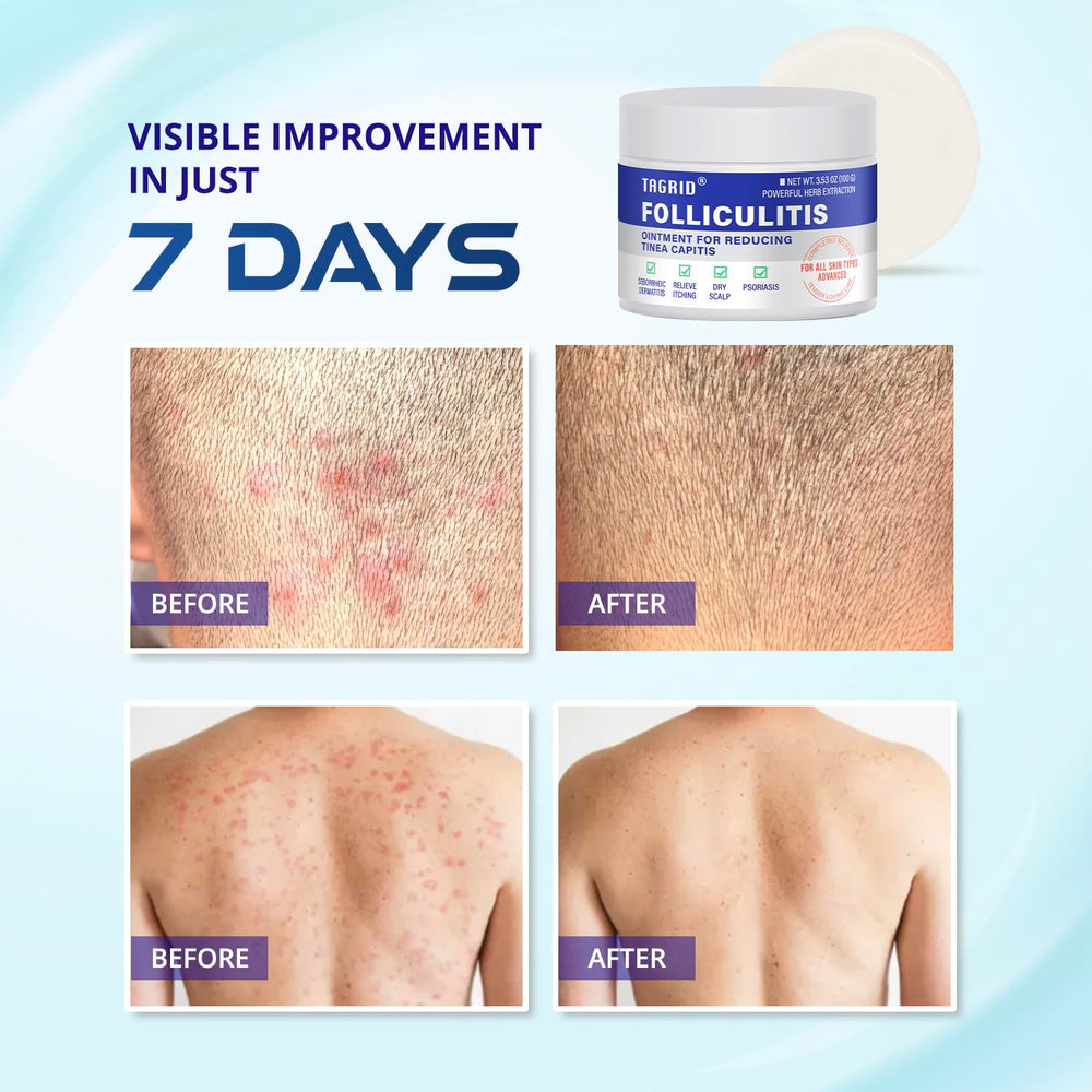Skin surface after use looks calmer and less irritated.