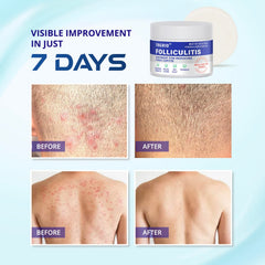 Skin surface after use looks calmer and less irritated.
