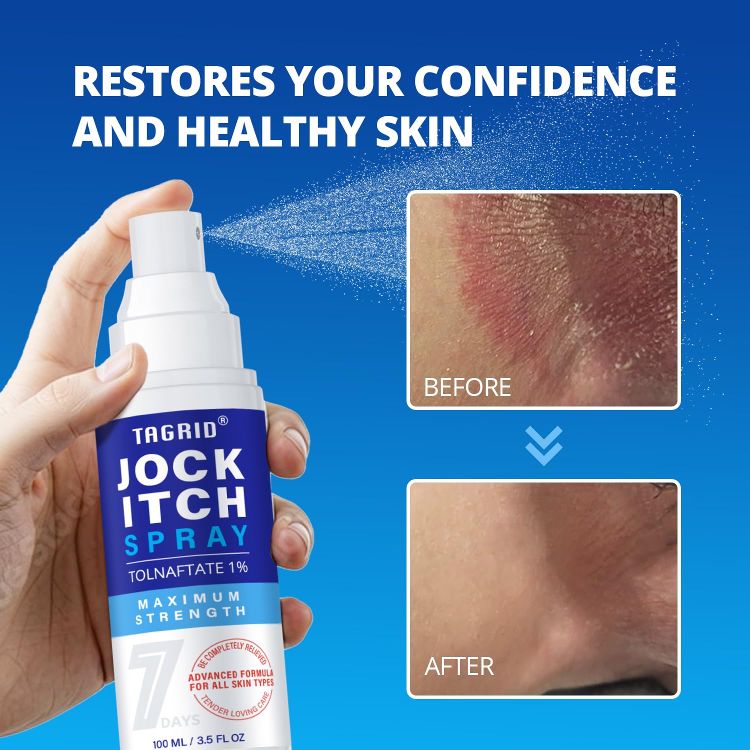 TAGRID Jock Itch Spray supports quick comfort with no sticky feel