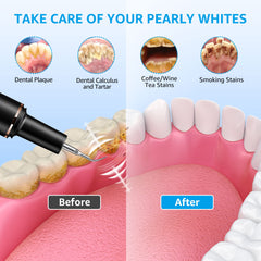 TANAVE plaque remover flat head for efficient surface cleaning.