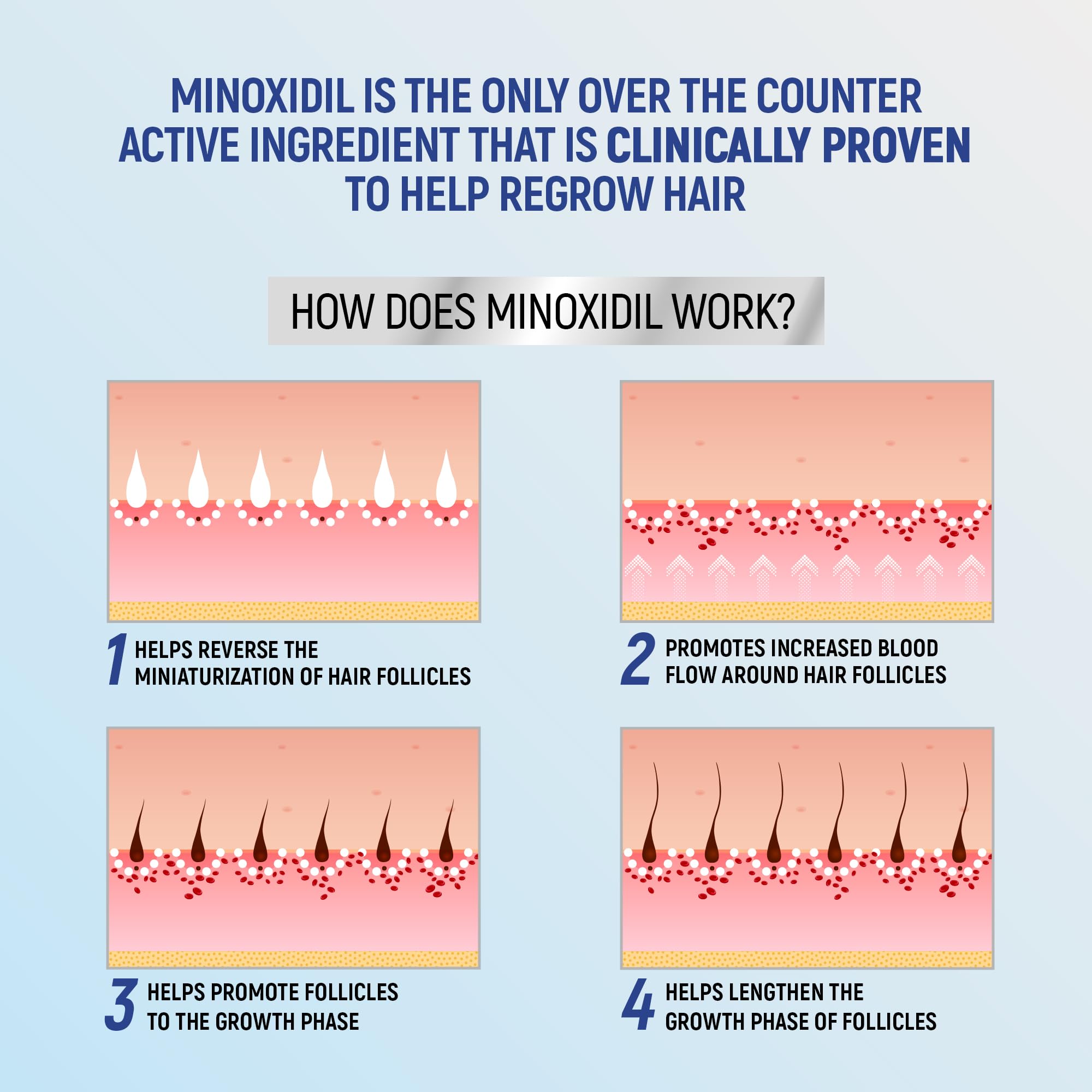 TARO Minoxidil 5% foam pack of four bottles for extended months.
