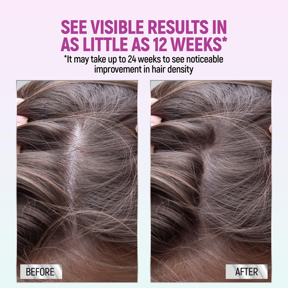 TARO Minoxidil 5% Women Foam box and tube showing two-month supply.