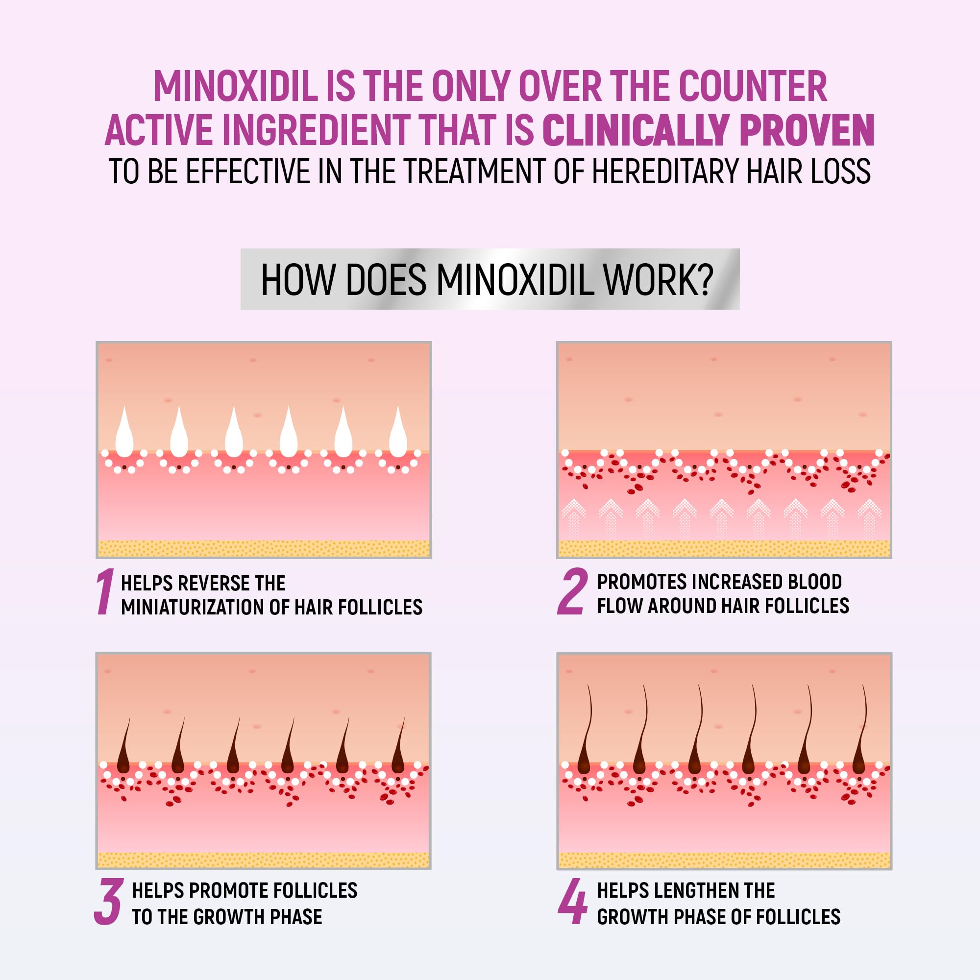 TARO Minoxidil 5% Women Foam pump dispenses for mess-free application.