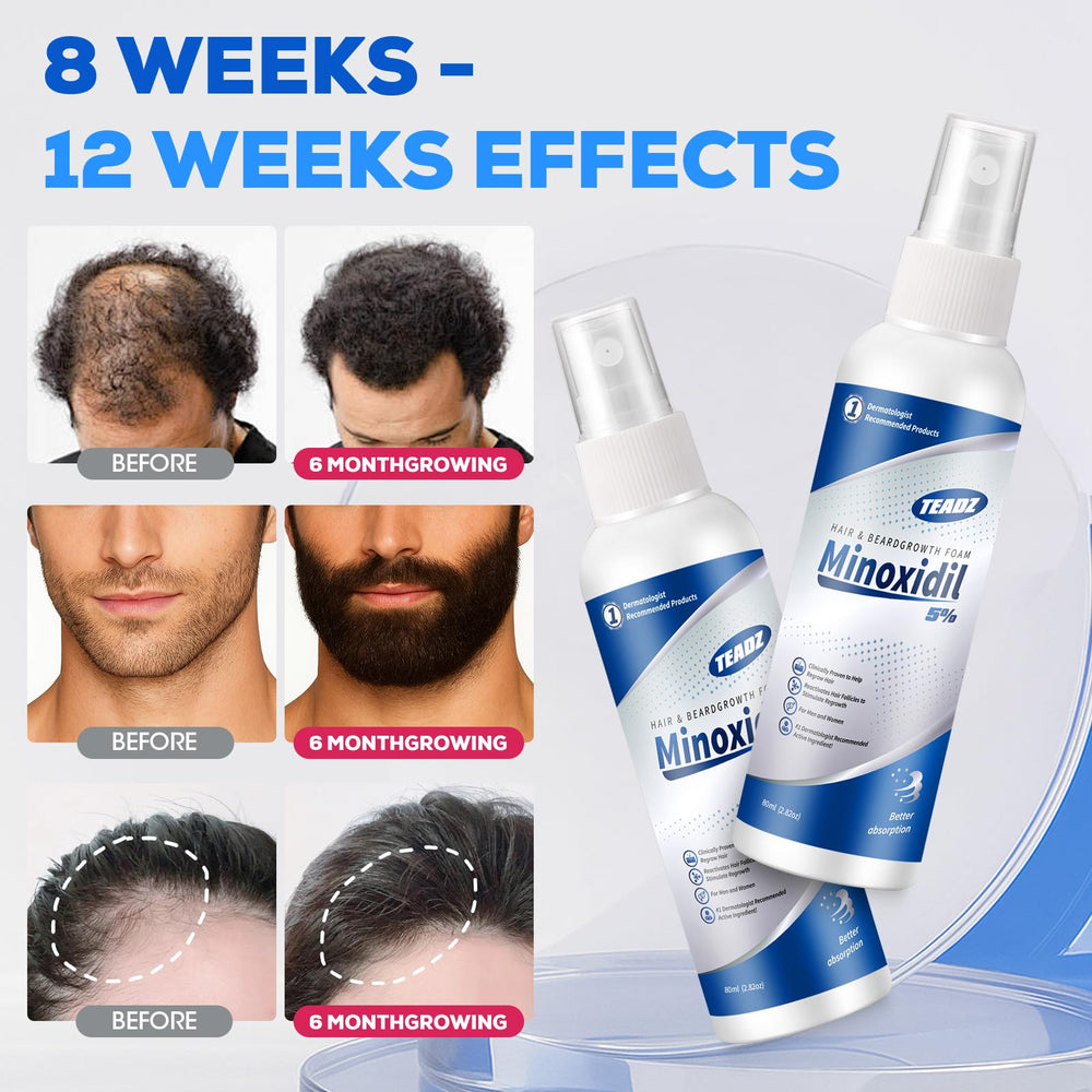 TEADZ Minoxidil shows a clinical-like 12-week growth timeline context.