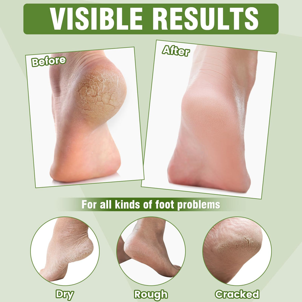 TEAWOO foot mask highlighting vitamin E and urea benefits for renewed skin.