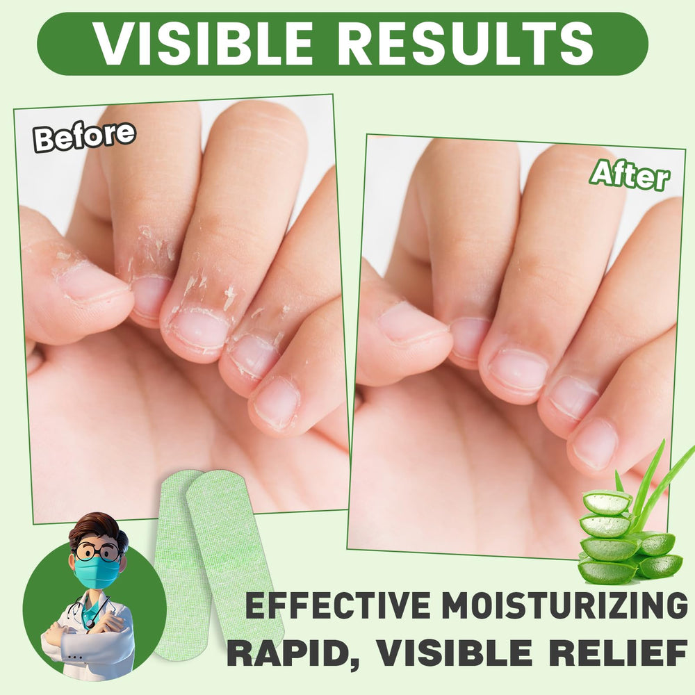 TEAWOO Hand Patches on cracked skin showing relief during wear.