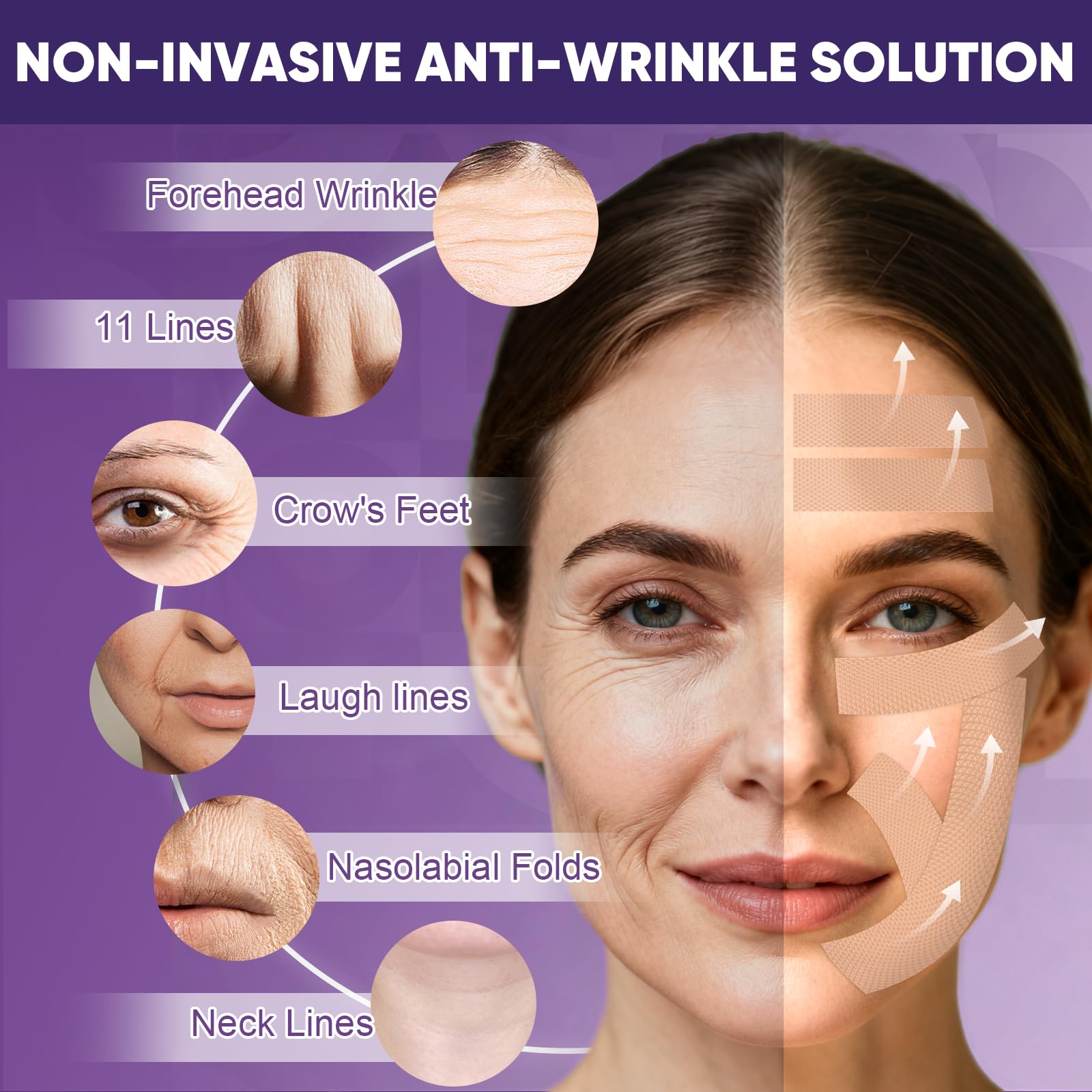 TEAWOO wrinkle tape on nasolabial folds for subtle improvement.