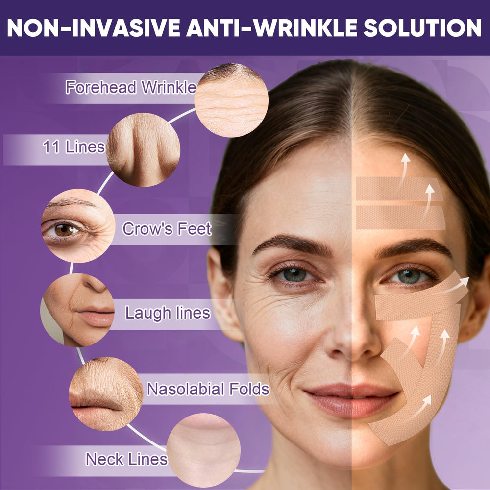 TEAWOO wrinkle tape on nasolabial folds for subtle improvement.