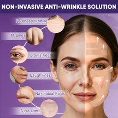 TEAWOO wrinkle tape on nasolabial folds for subtle improvement.