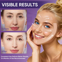 TEAWOO silicone scar tape refines texture and appearance.