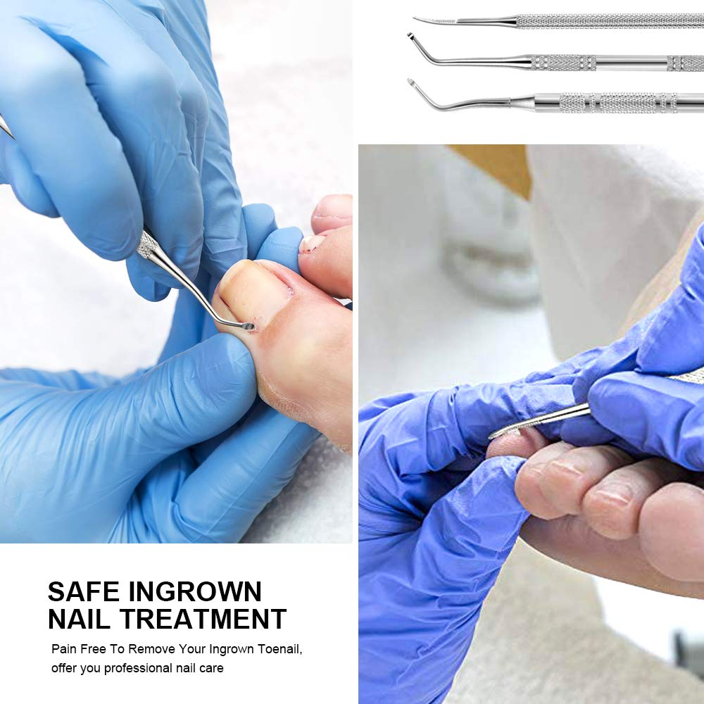 Teenitor home solution for ingrown nails kit for convenient self-care.