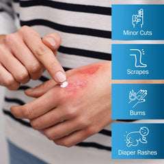 TenderGentle skin protectant ointment demonstrates drying support for irritated skin