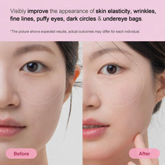 TEREZ & HONOR eye patches applied to smile lines highlight multi-zone use.