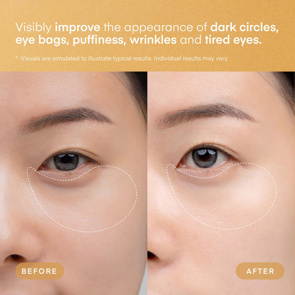 TEREZ & HONOR non-slip hydrogel patch application stays in place