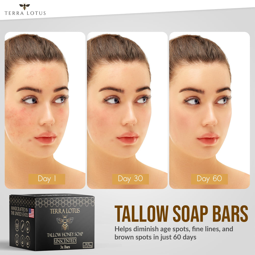 Terra Lotus creamy-lather soap shows gentle cleansing and nourishment.