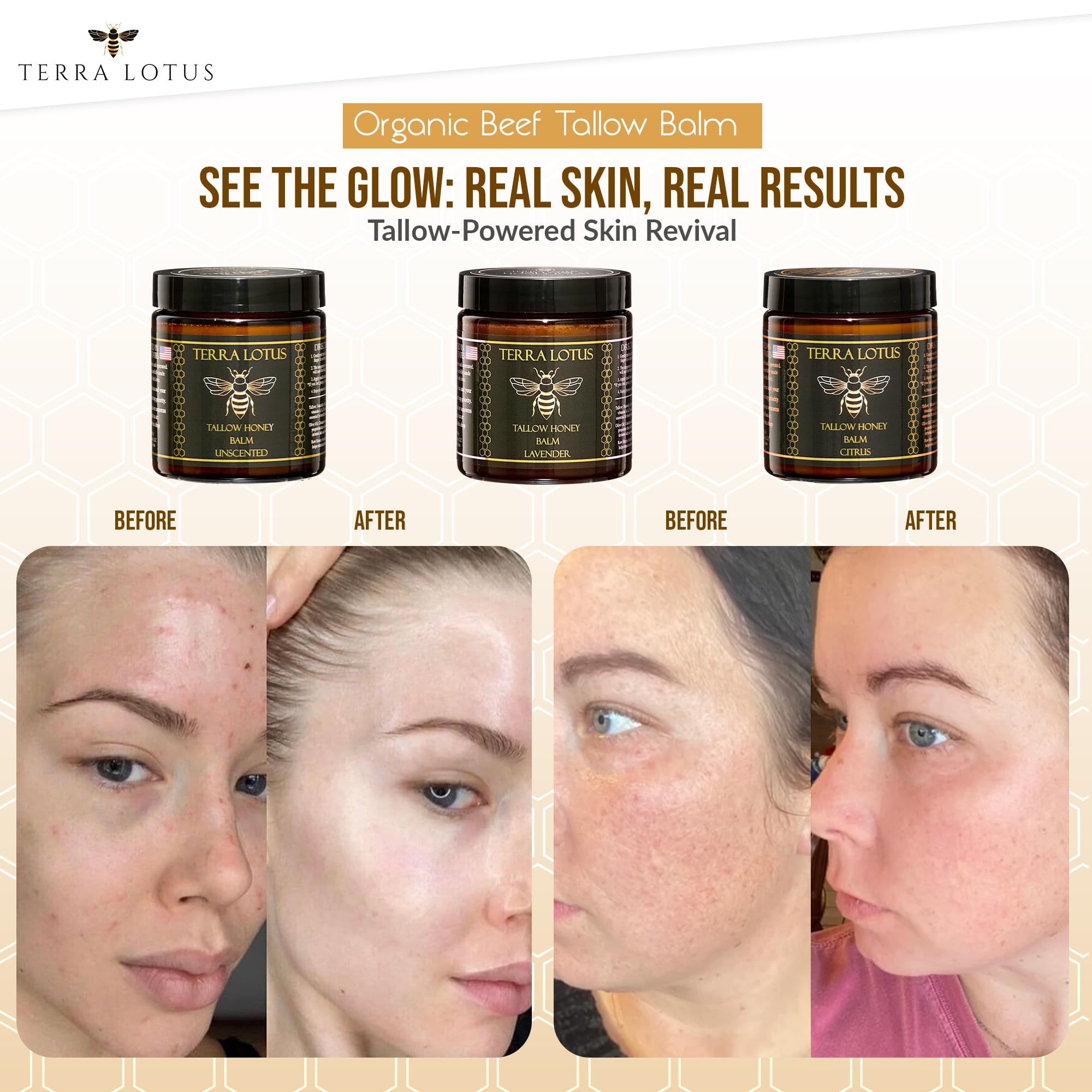 Terra Lotus balm on hands and feet provides lasting moisture.