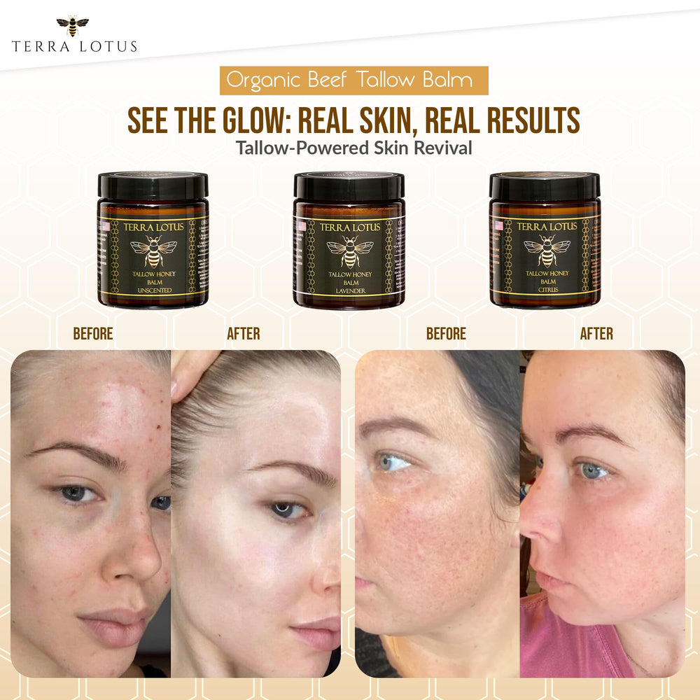 Terra Lotus balm on hands and feet provides lasting moisture.