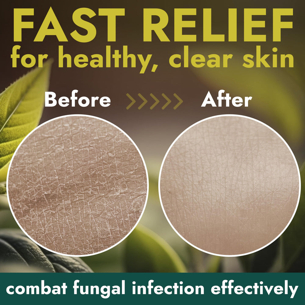 Terramed Just Think Comfort Antifungal ingredient label and 16.9 oz size
