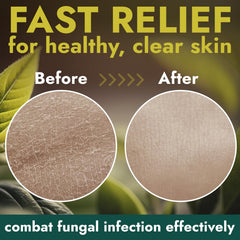 Terramed Just Think Comfort Antifungal ingredient label and 16.9 oz size