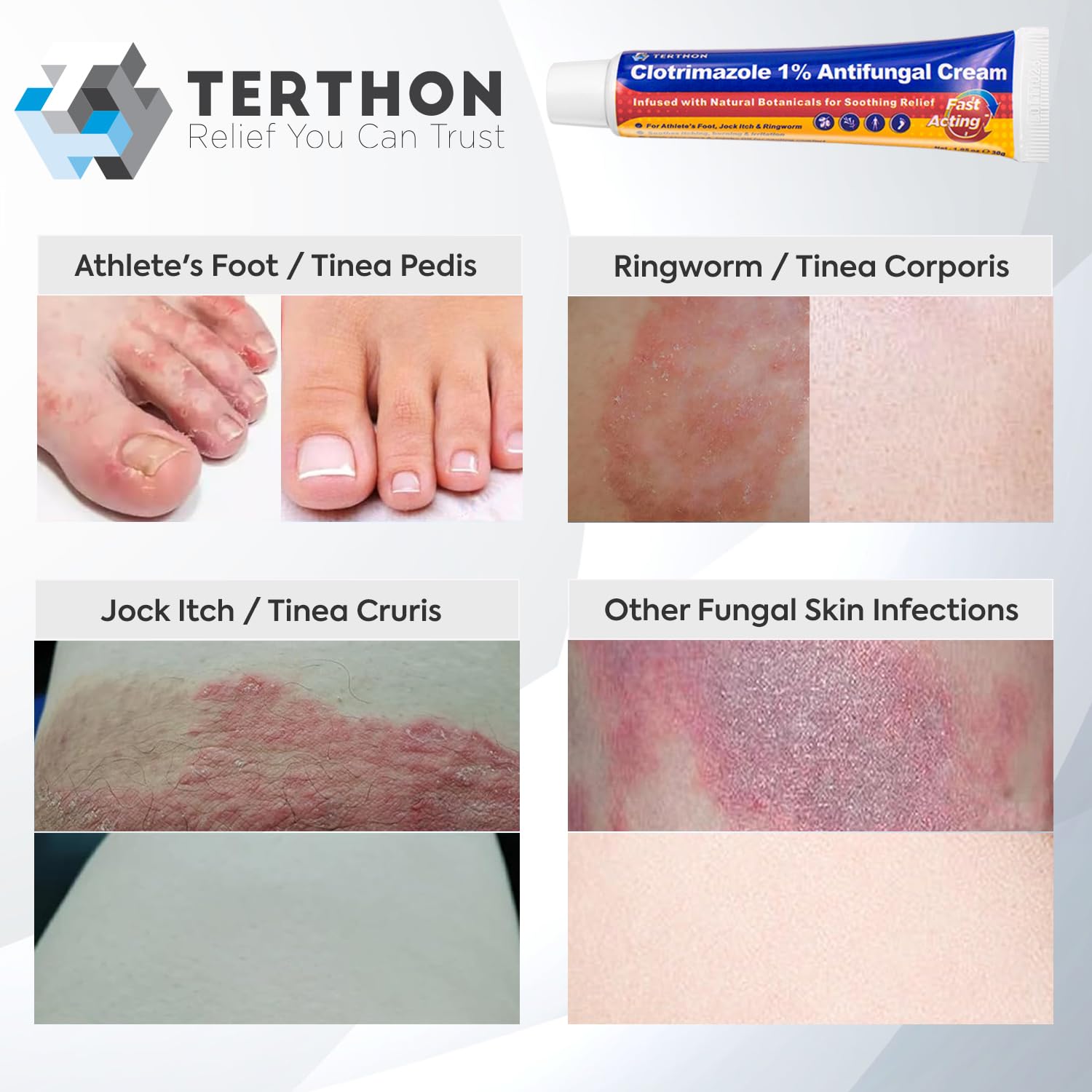 Terthon Antifungal Cream cooling effect image emphasizes camphor and peppermint