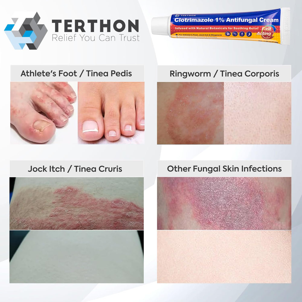 Terthon Antifungal Cream cooling effect image emphasizes camphor and peppermint