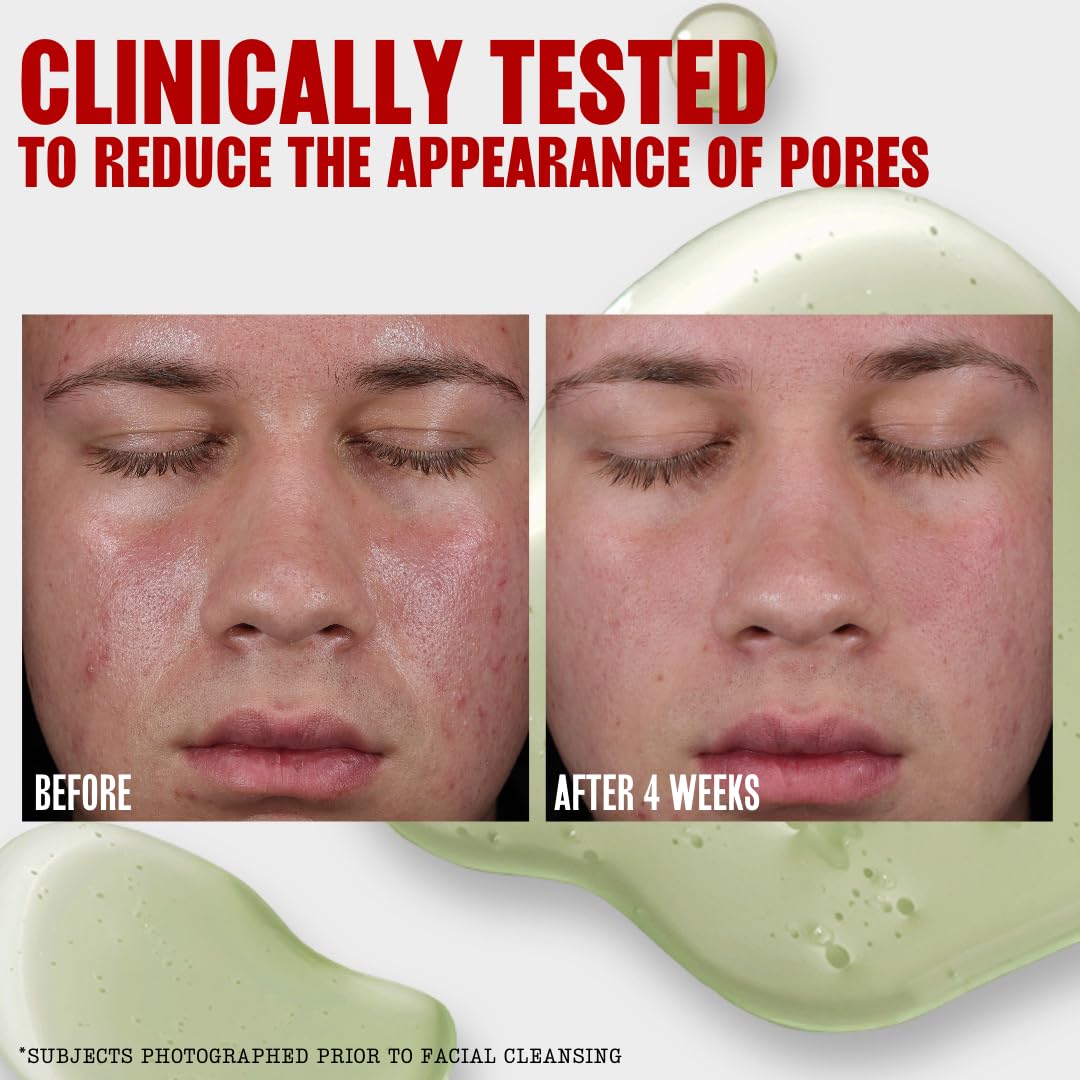 Thayers Jelly Toner delivers a soft matte finish on the skin.