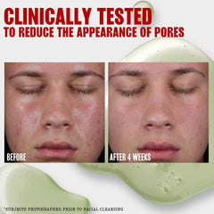 Thayers Jelly Toner delivers a soft matte finish on the skin.