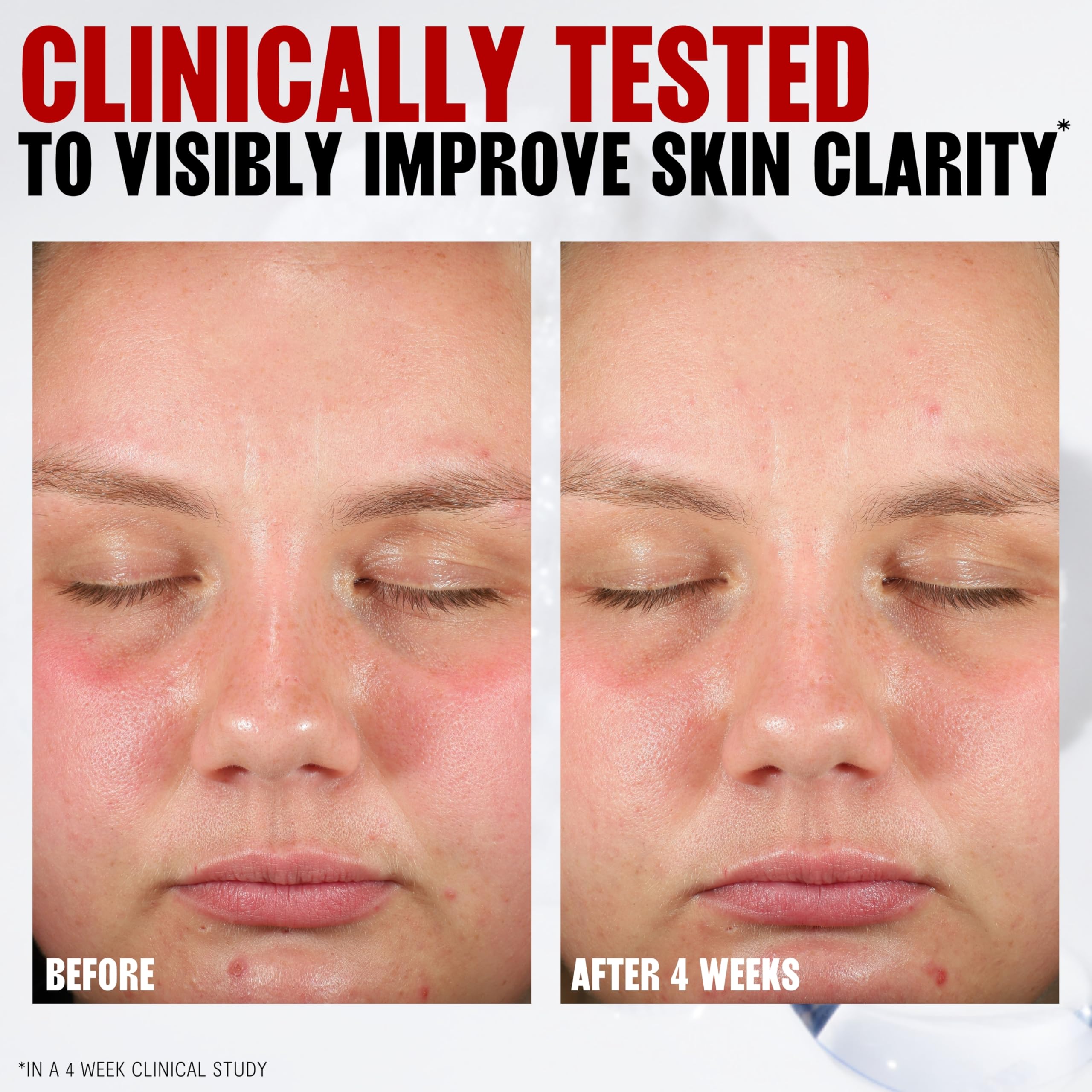 Thayers Pore Refining Pads smooth side wipe, showing clean skin surface.