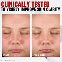 Thayers Pore Refining Pads smooth side wipe, showing clean skin surface.