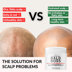 The Bald Brothers Bald Boss bottle pump for easy one-handed application.