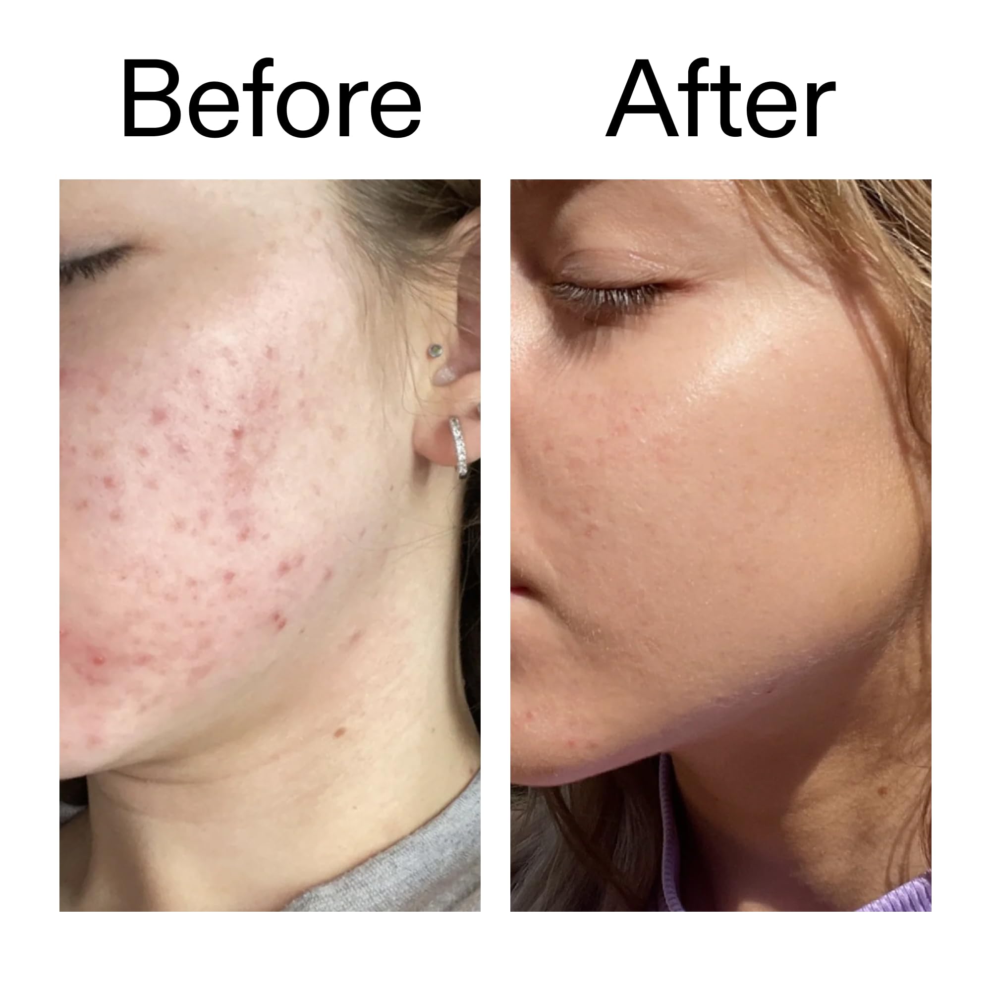 The INKEY List Niacinamide serum with other serums suggesting versatile layering