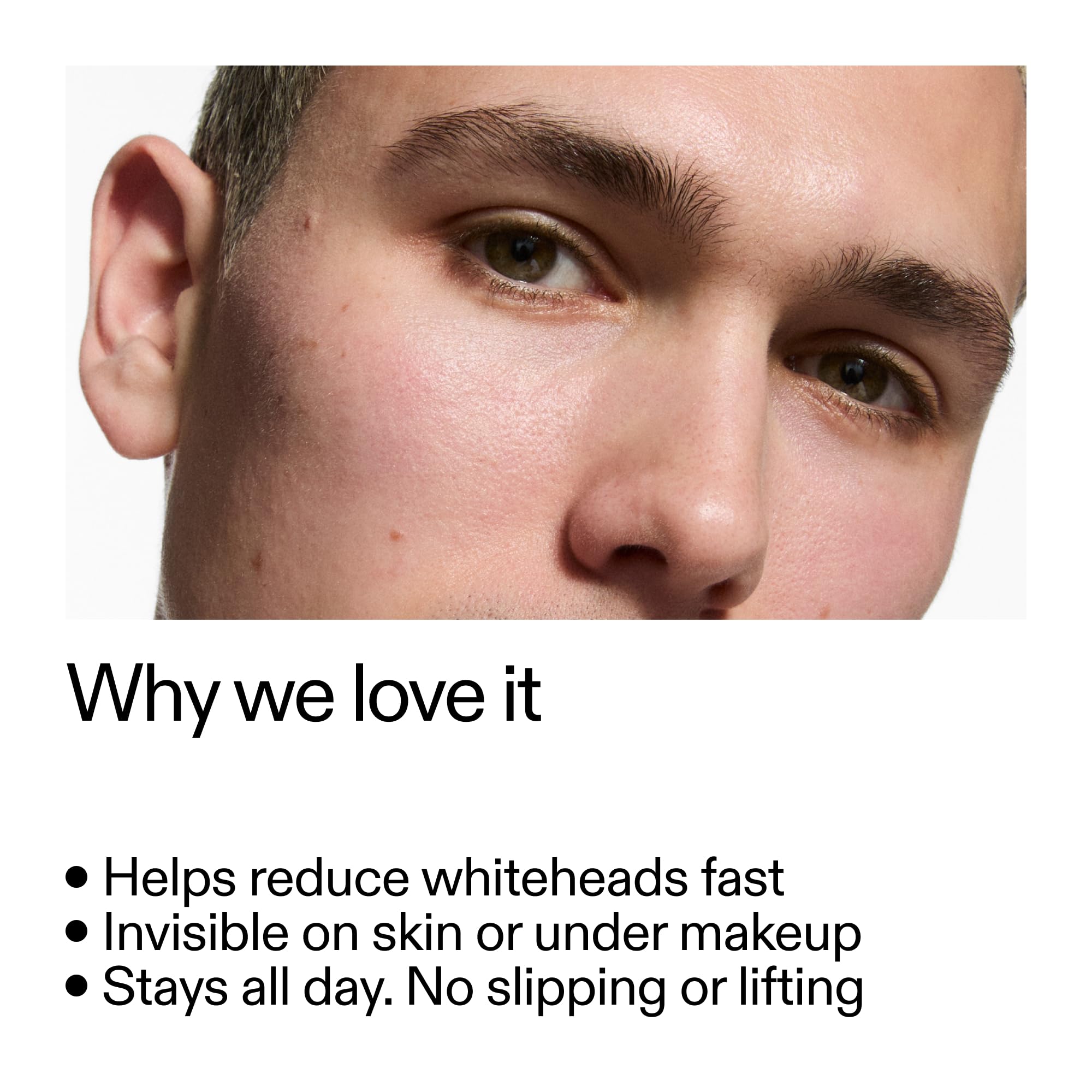 The INKEY List pimple patch closeup on skin demonstrates ultra-thin, matte finish for undetectable wear.