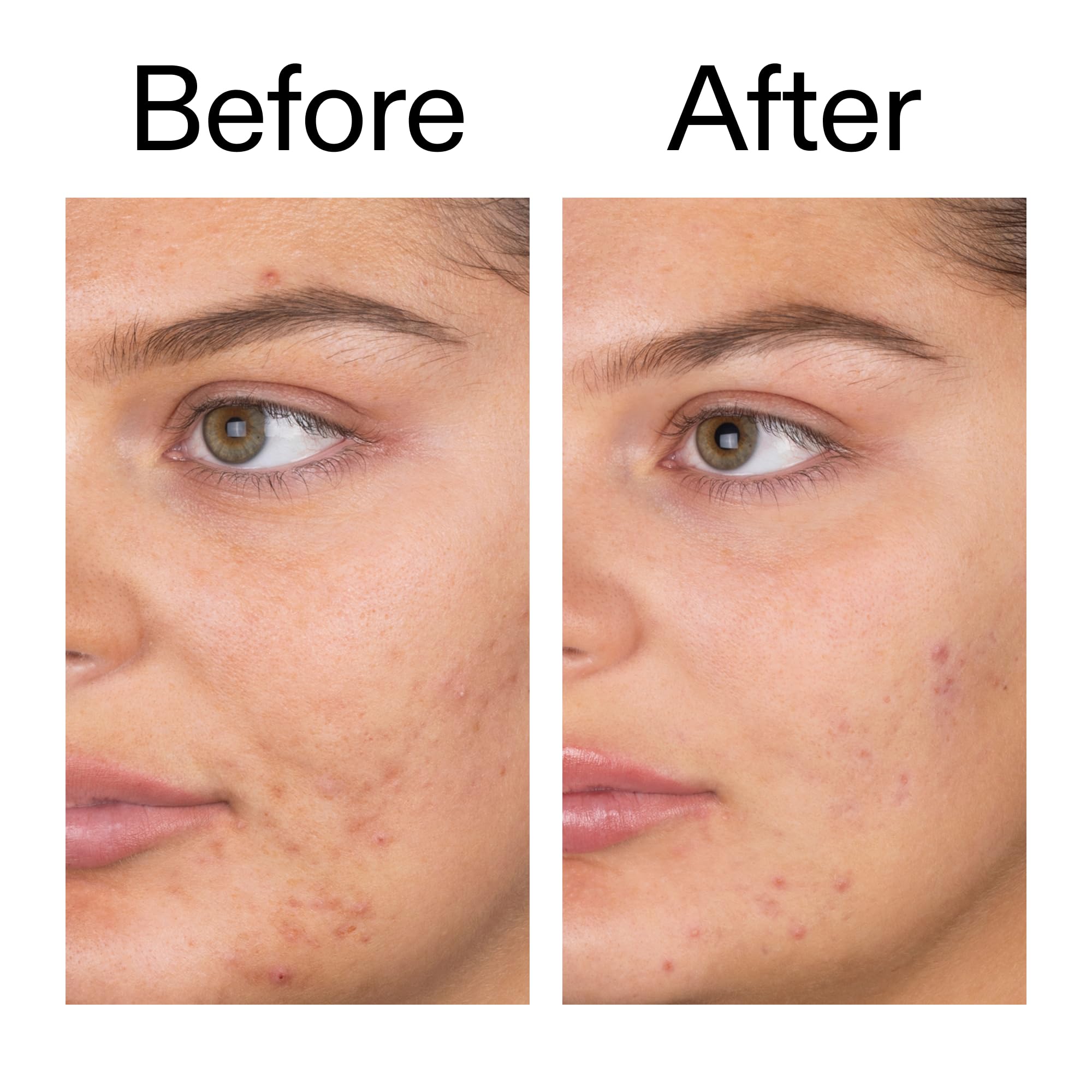 The INKEY List daily routine shot shows morning cleanse before moisturizer
