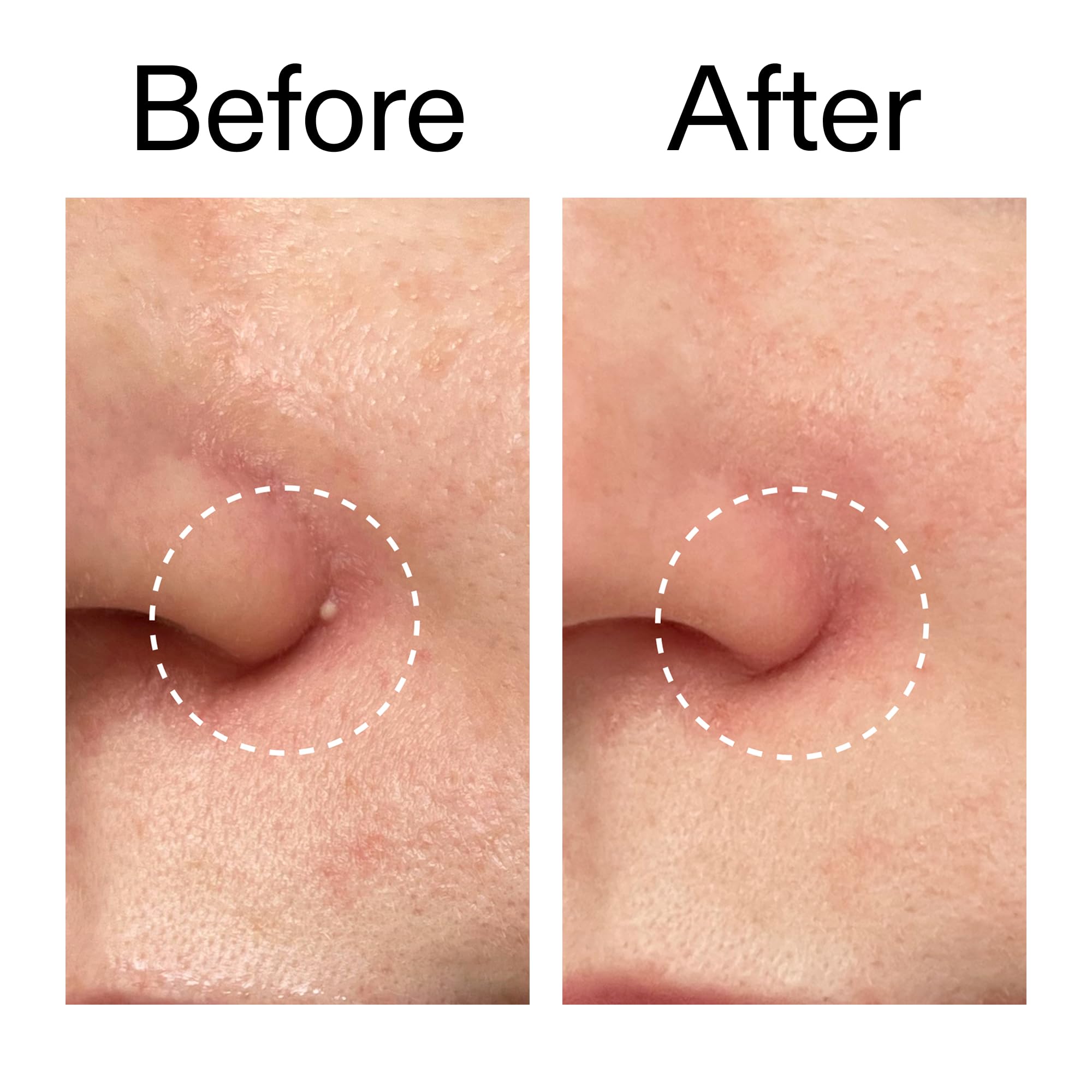 The INKEY List patch application demonstrates simple, fast use on cleansed skin.