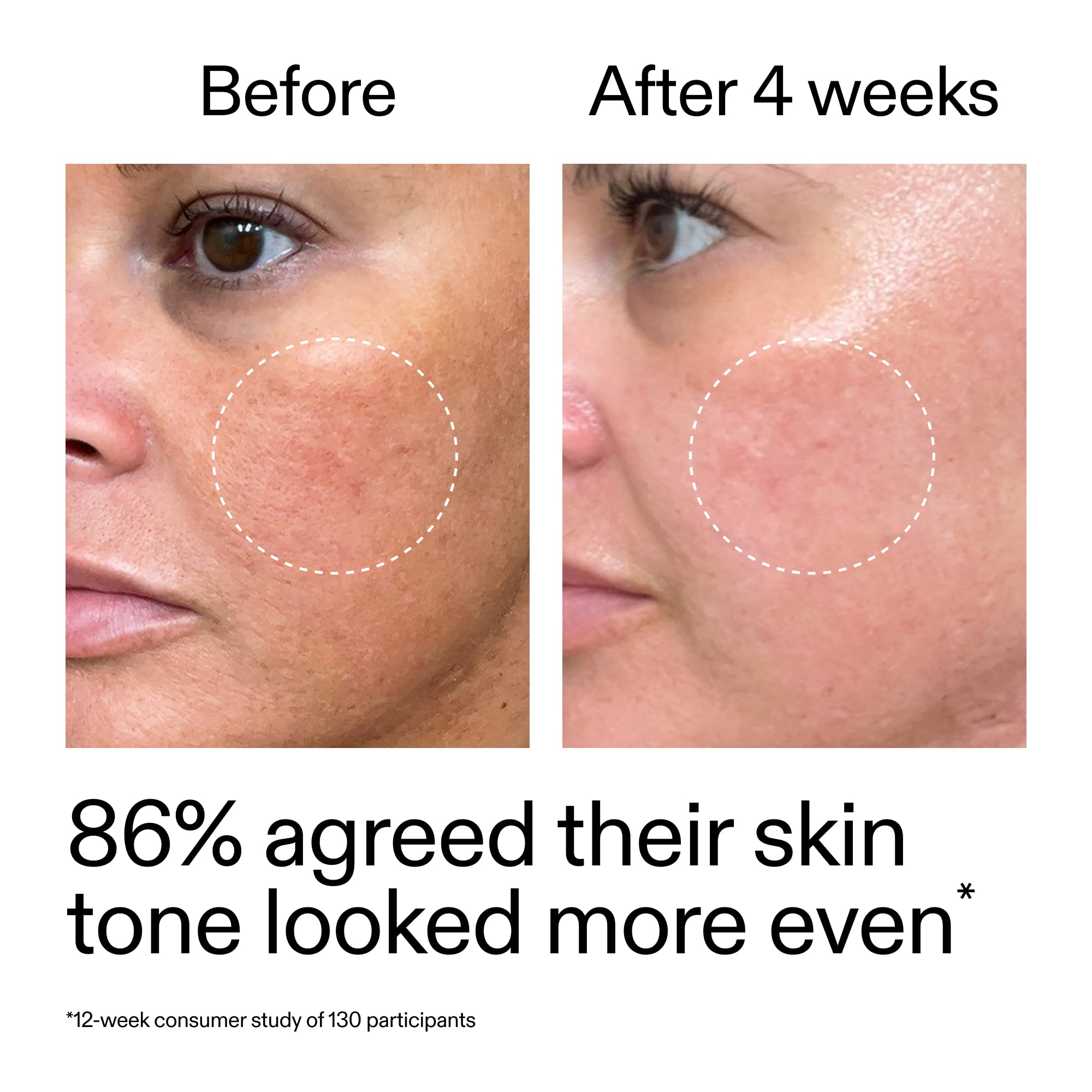 Next-morning sunscreen after The INKEY List Starter Dual Retinol Serum use.
