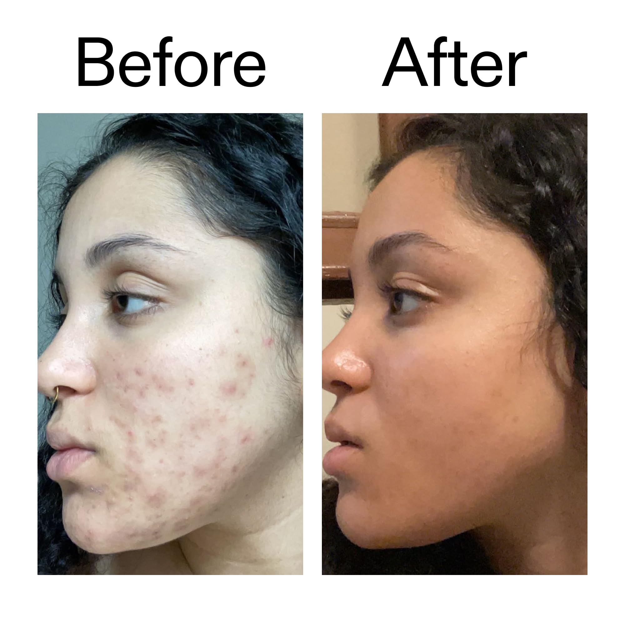 The INKEY List Tranexamic Acid Serum fits into your skincare routine for a balanced complexion
